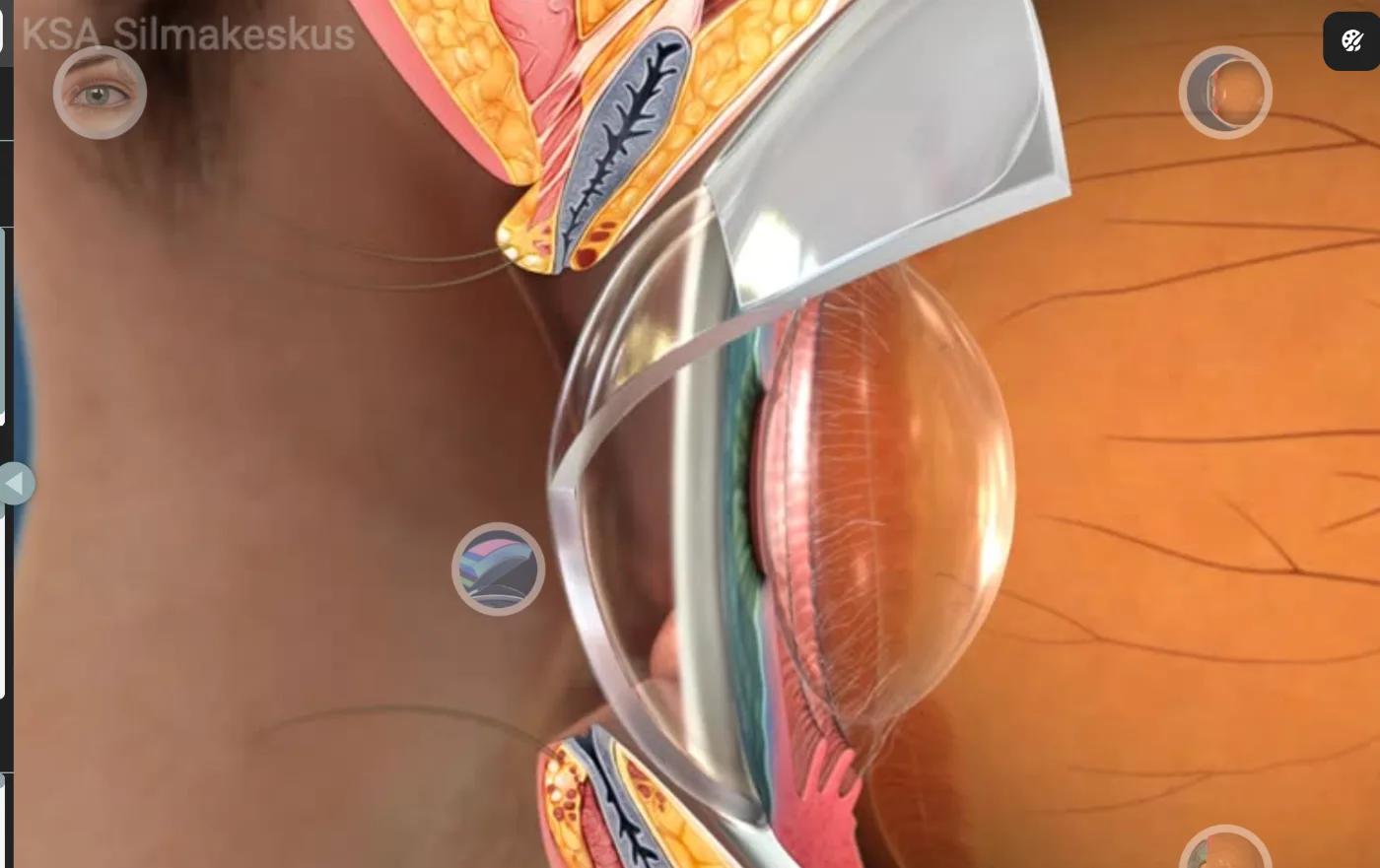 Ülim häiresüsteem: miks on sarvkest sinu keha kõige tundlikum osa?